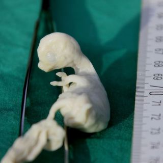 Ein Embryo; die Stute schied das Fohlen 52 Tage nach der Befruchtung aus